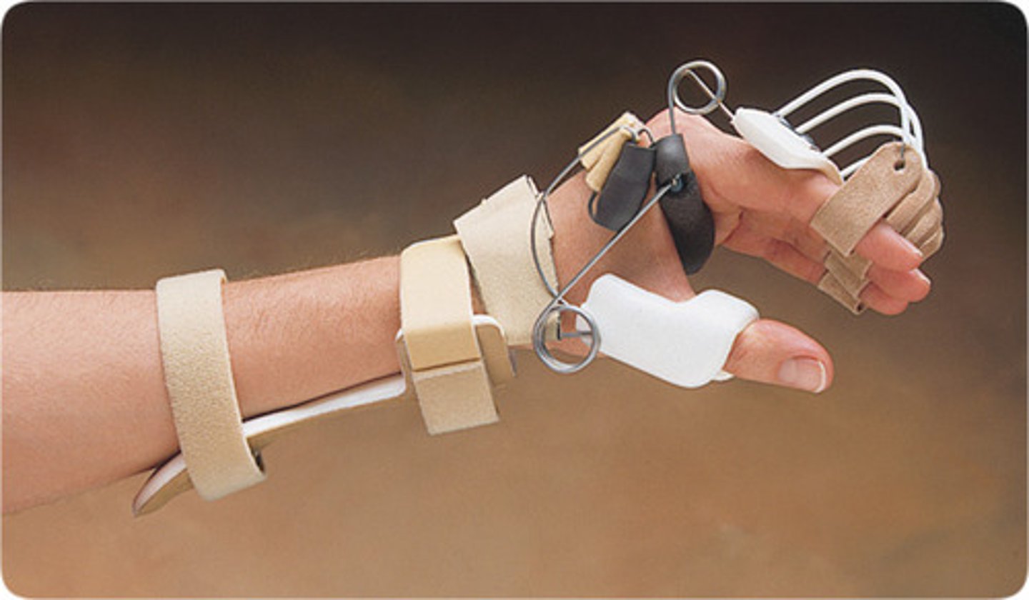 <p>For radial nerve injury</p>