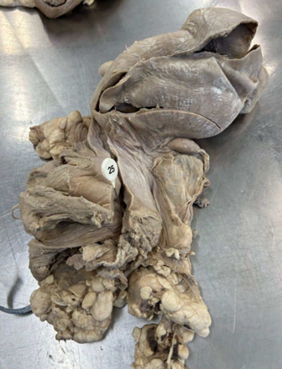 <p>What is the parent of the artery that supplies this region?</p>