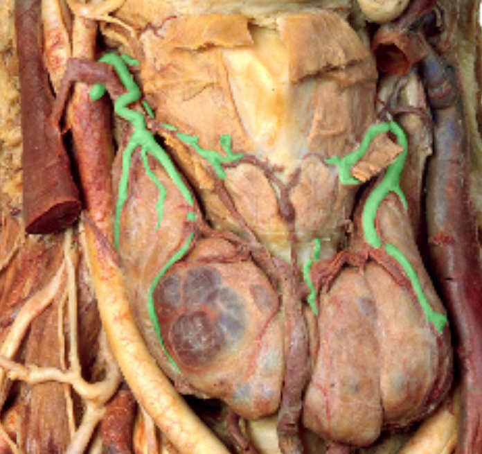 <p>Which artery?</p>