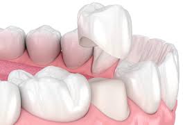 <p>Gedeelte vd tand dat met glazuur bedekt is</p>