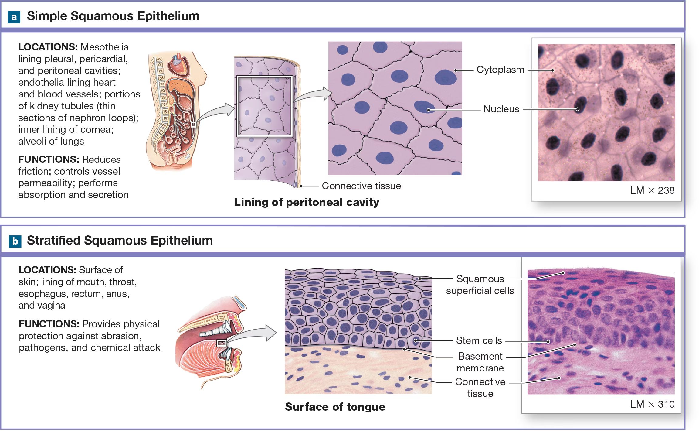<p>Simple Squamous Epithelium </p>