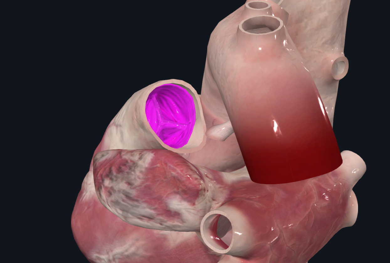 <p>Válvulas semilunares que permiten el paso de sangre venosa a la arteria pulmonar. Son 3. Abiertas en sístole</p>
