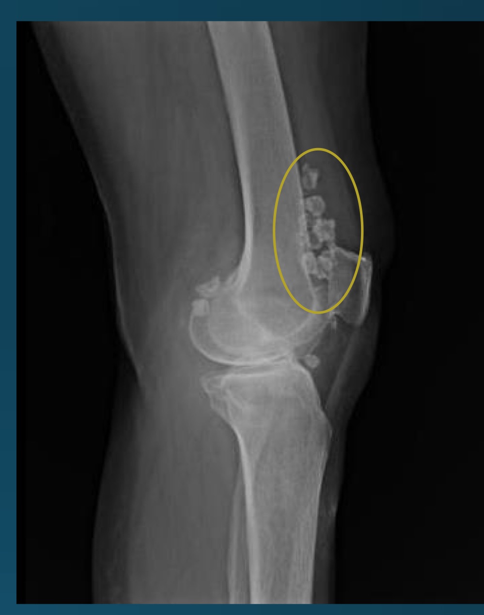 <p>what is this finding? </p>