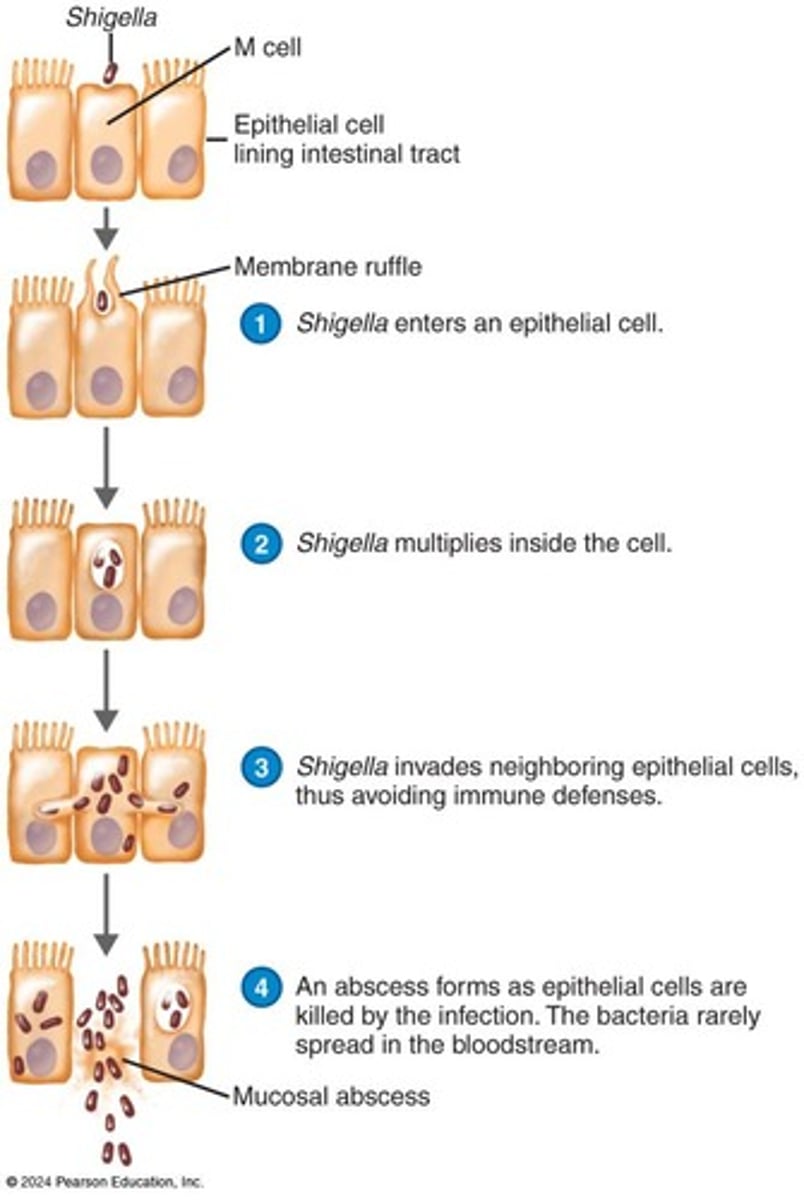 <p>Bacillary dysentery</p>