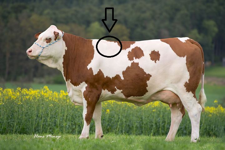 <p>What type of injection is given well behind the shoulder?</p>