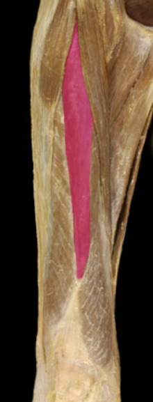 <p>front of thigh, medial, superficial</p>