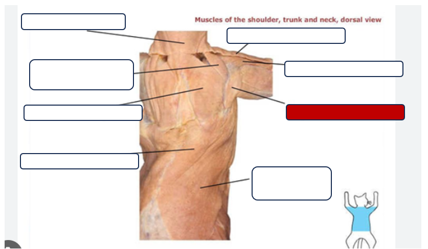 <p>Label the muscle</p>