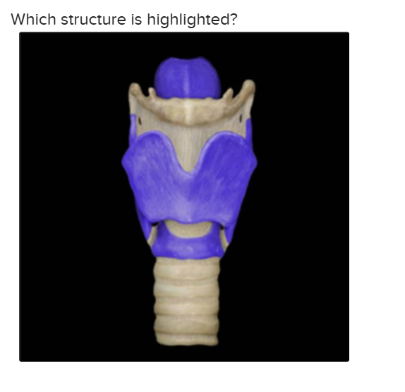 <p>The highlighted structure is: </p>