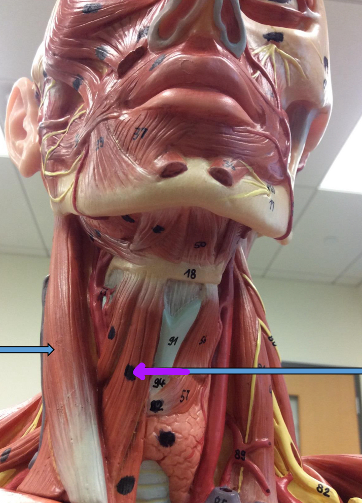 <p>Identify this muscle?</p>