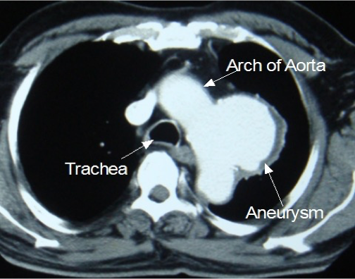 <p>What does this CT refer to</p>