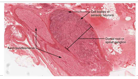 <p>what is the histology image of</p>