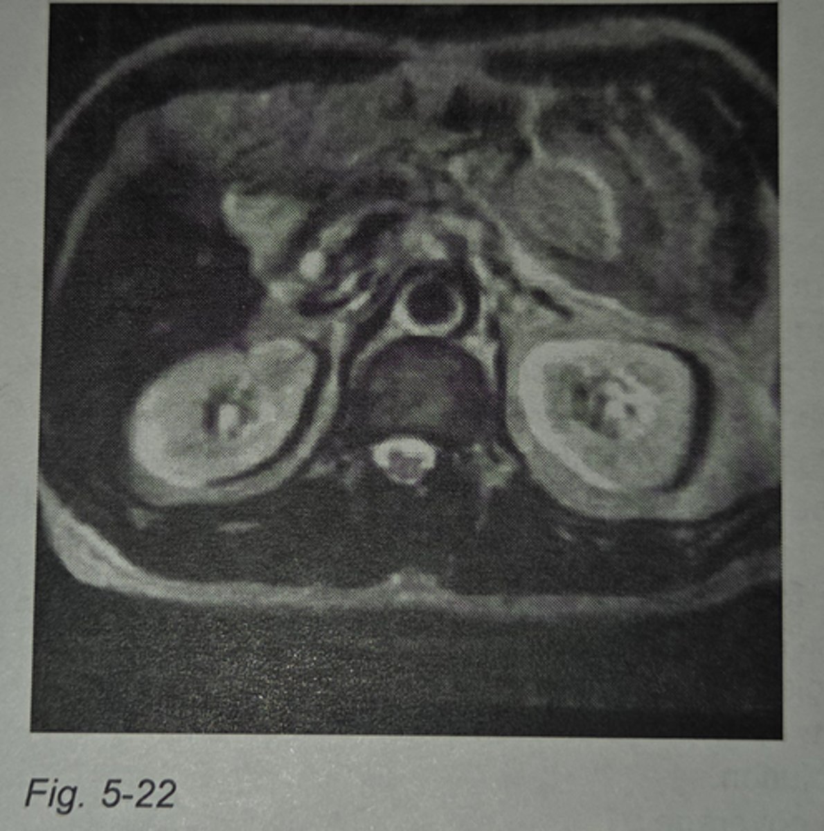 <p>from left to right</p><p>3 multiple choice options</p>