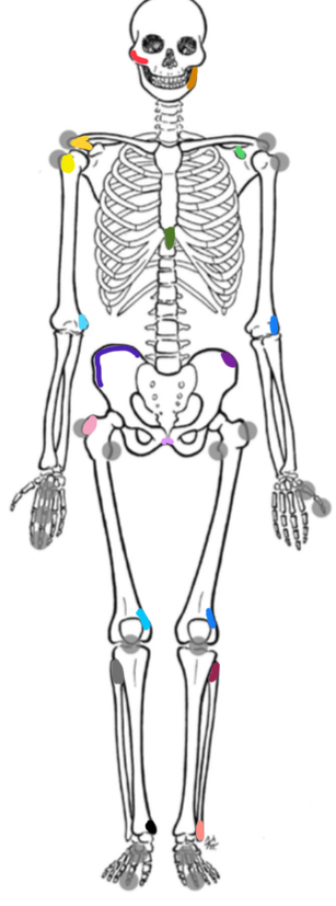 <p>What marking is yellow-orange</p>
