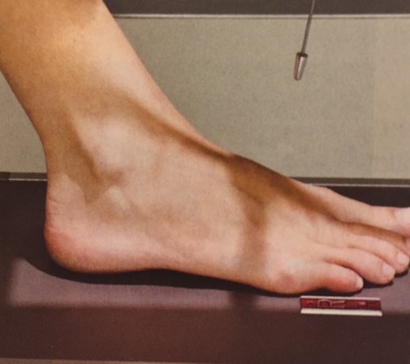 <p>Describes the path of the CR from the dorsal (anterior) surface to the plantar (posterior) surface of the foot.</p>