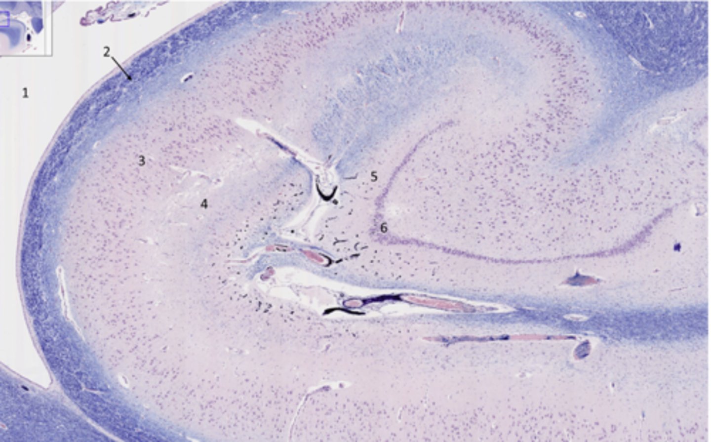 <p>What part of the hippocampus is at 5 and 6</p>