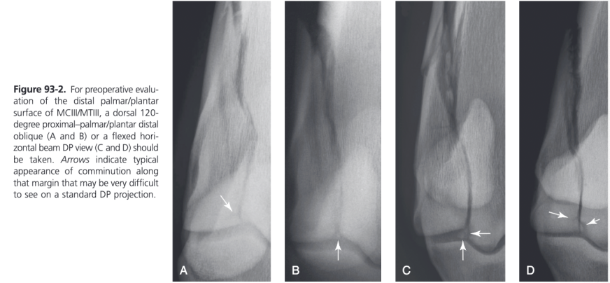 <ul><li><p><span>Many horses have preexisting degenerative disease involving the distal palmar/plantar condyle adjacent to the base of the ispsilateral proximal sesamoid bone so an additional radiographic projection further defining this region should be taken</span></p><ul><li><p><span>Silhouetting of the distal palmar/plantar condyle can be obtained in slight flexion with the beam angled proximally or by putting the joint in more flexion with the limb pulled forward and using a horizontal beam</span></p></li><li><p><span>Should be used in all displaced condylar fractures because comminution along the fracture line is commonly identified in this location</span></p></li></ul></li></ul>