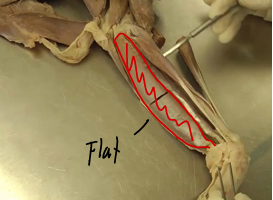 <p><span>Antebrachial Region (Forearm)</span></p>