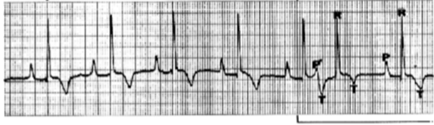 <p>Describe EKG</p>
