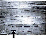 <p>The image at right is a longitudinal cross section through tendon and the dark structures (arrow) are the ________.</p><p>a. collagen bundles </p><p>b. proteoglycan molecules </p><p>c. fibroblast nuclei</p>