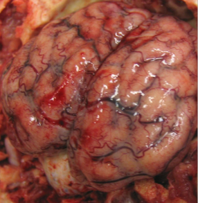 <p>What type of pathogen?</p>