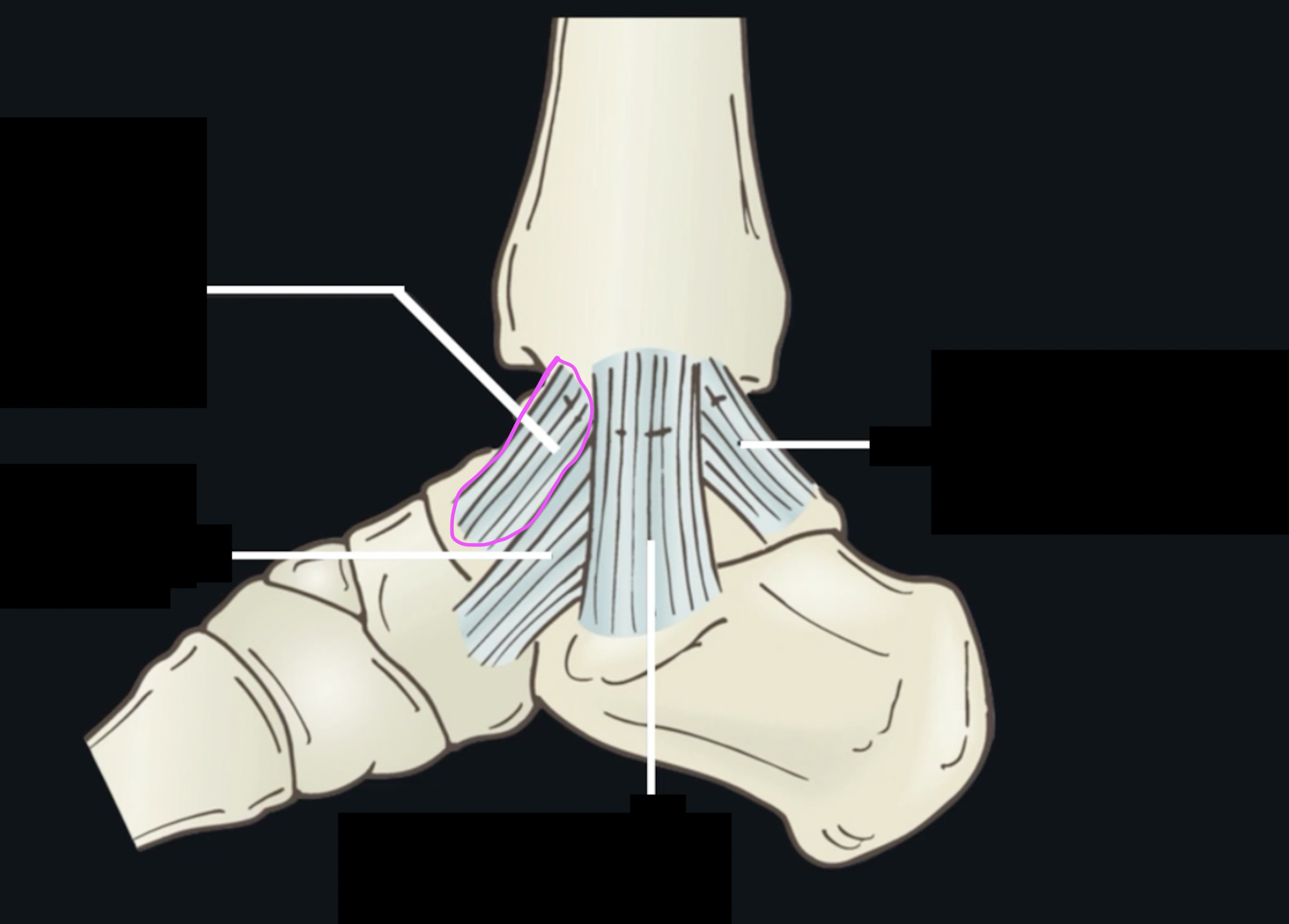 <p>What ligament is this? </p>