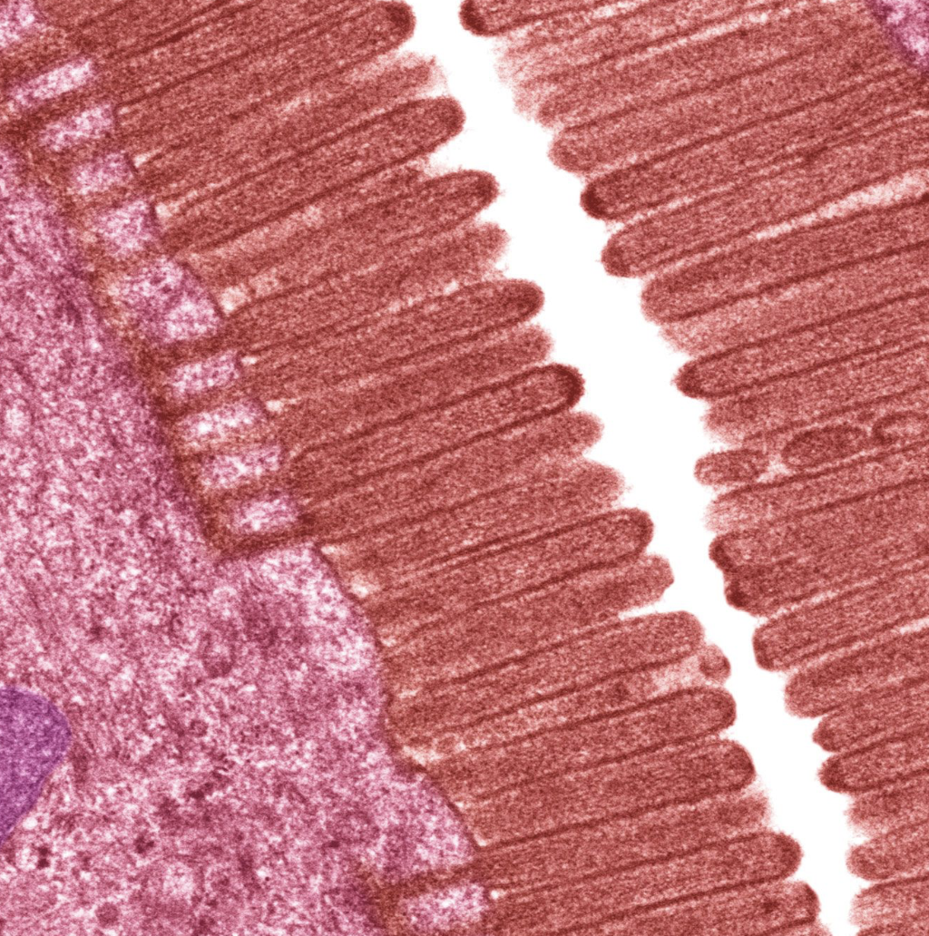<p>cytoplasmic extensions of mucosal cell that increases surface areatan</p>