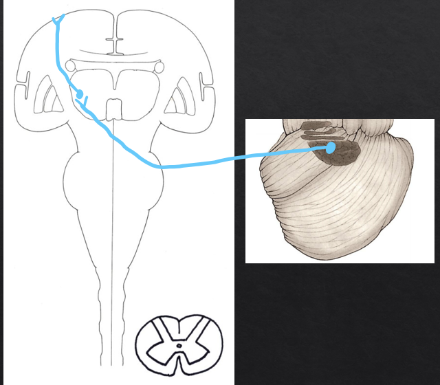 <p>(Dentatothalamic fibers) Dentate nucleus→ Superior cerebellar peduncle and decussation→ Thalamus</p><p>(Thalamocortical fibers) Thalamus→ internal capsule→ Motor cortex</p>