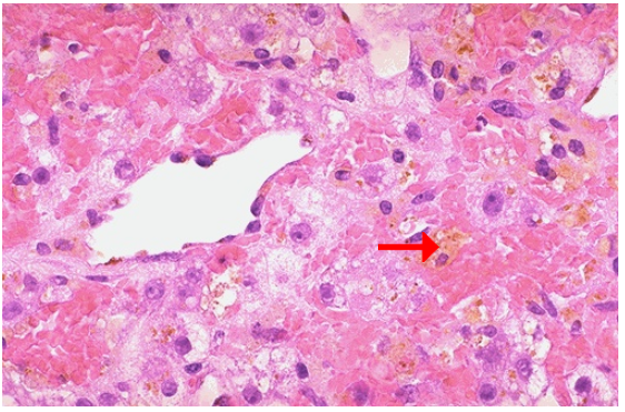 <ol><li><p>Identify</p></li><li><p>What causes this cellular adaptation to occur?</p></li><li><p>Identify the pointed structure</p></li><li><p>What cellular process is occurring?</p></li></ol><p></p>