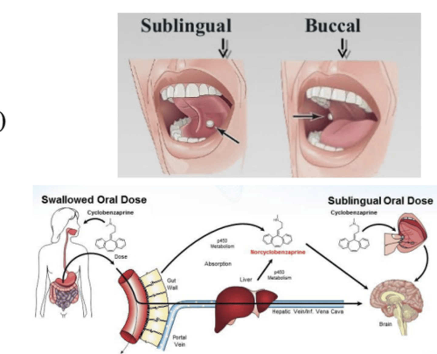 <p>- drugs diffuse through the oral mucosa and enter the bloodstream directly </p><p>- target: systemic</p><p>- dosage form: tablet, liquid (oral spray)</p><p>(e.g., fentanyl, nitroglycerin)</p>