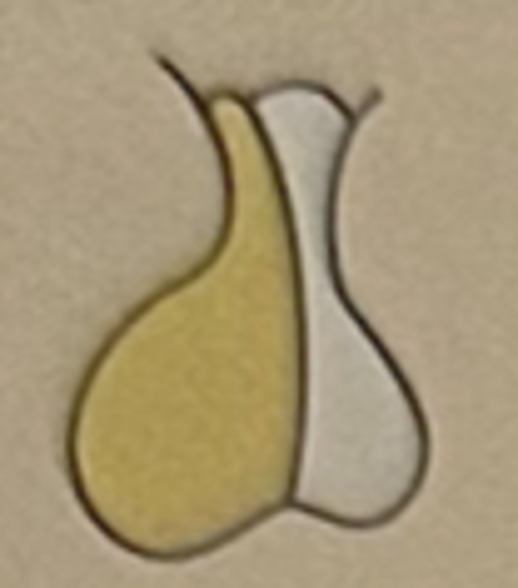 <p>Anterior pituitary (adenohypophysis)</p>