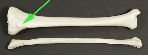 <p>Name the bony process indicated by the green arrow.</p>