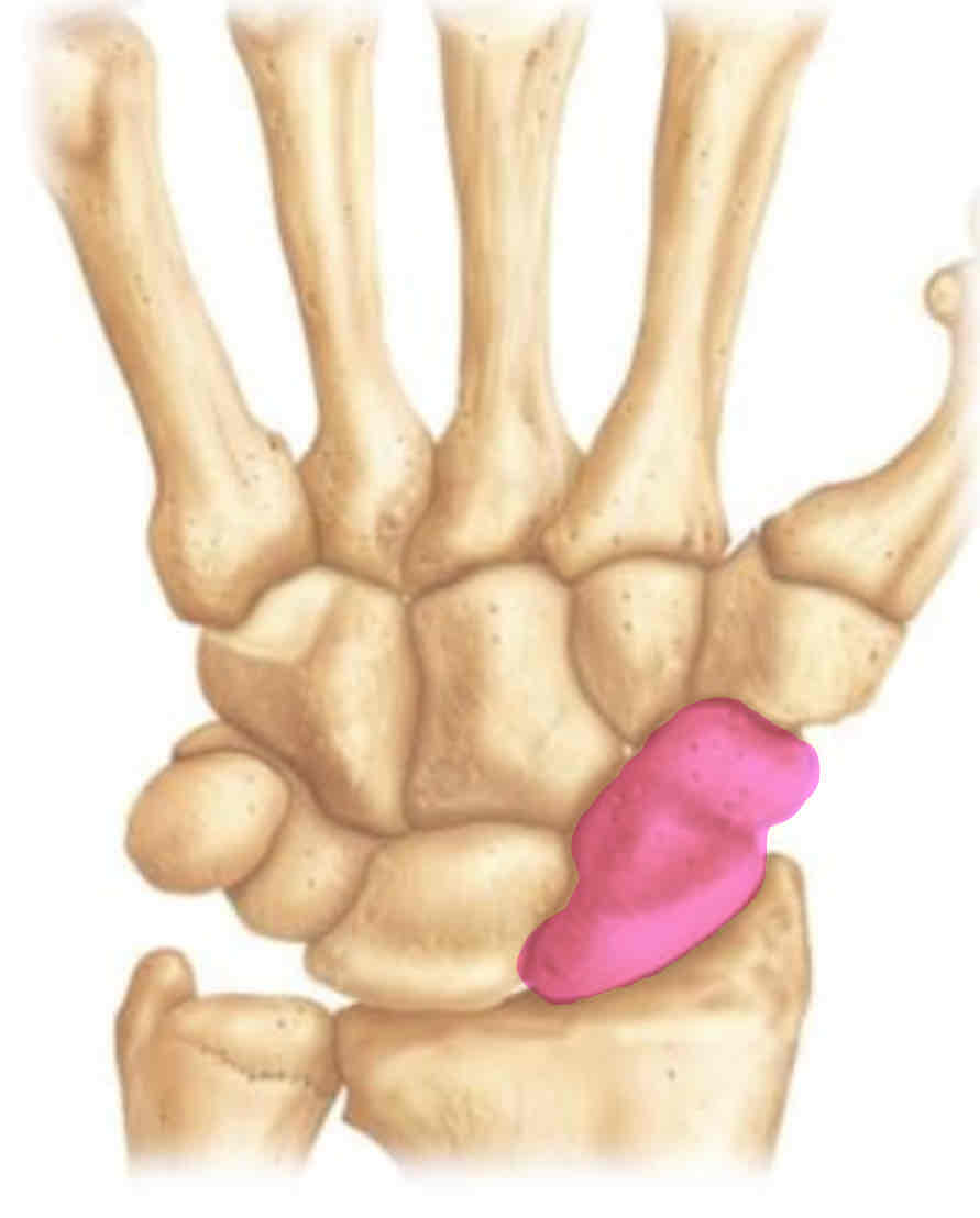 term image