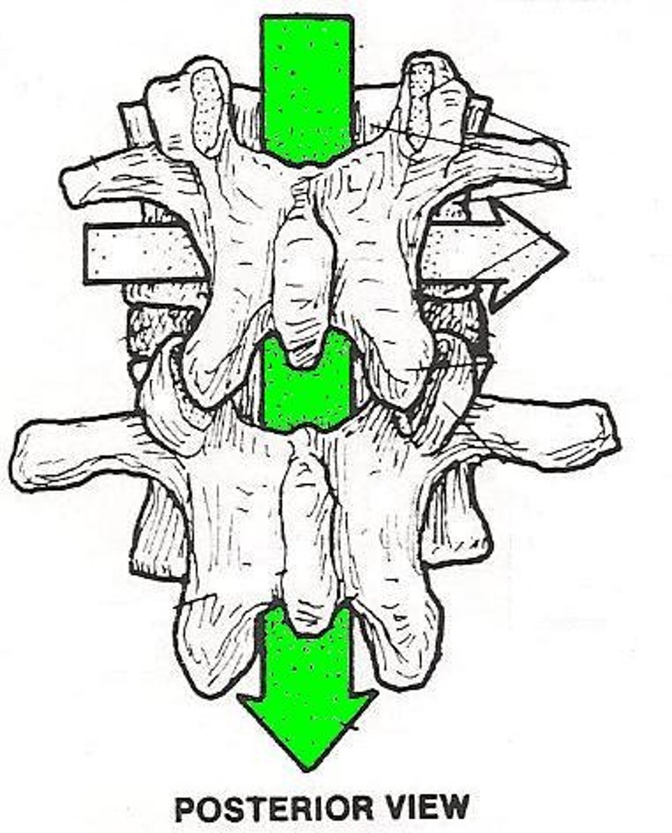 <p>Opening in the vertebral column where the spinal cord is located</p>