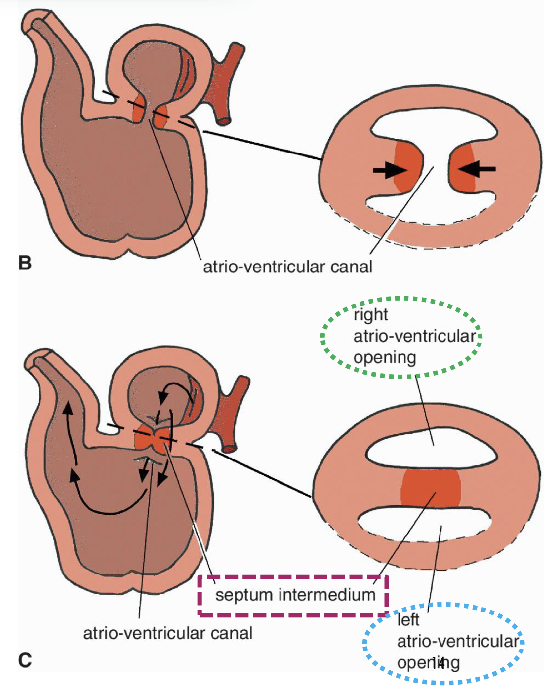 <p>Due to the development of<span style="color: purple"> <strong>endocardial cushions</strong></span><strong>:</strong></p><ul><li><p>They <span style="color: purple"><strong>grow</strong></span><strong> </strong>until they <span style="color: purple"><strong>fuse</strong></span><strong> </strong>in the middle of AV canal</p></li><li><p>Dividing the canal into <span style="color: purple"><strong>right</strong></span><strong> </strong>and <span style="color: purple"><strong>left atrio-ventricular channels </strong></span></p></li></ul><p></p>