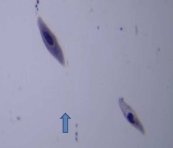 <p>Identify the alveolate</p>
