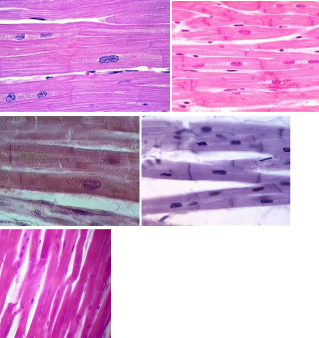 <p><strong>Cardiac muscle tissue</strong></p>