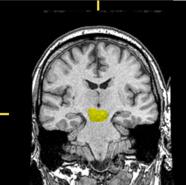 <p>What part of the brain is highlighted?</p>