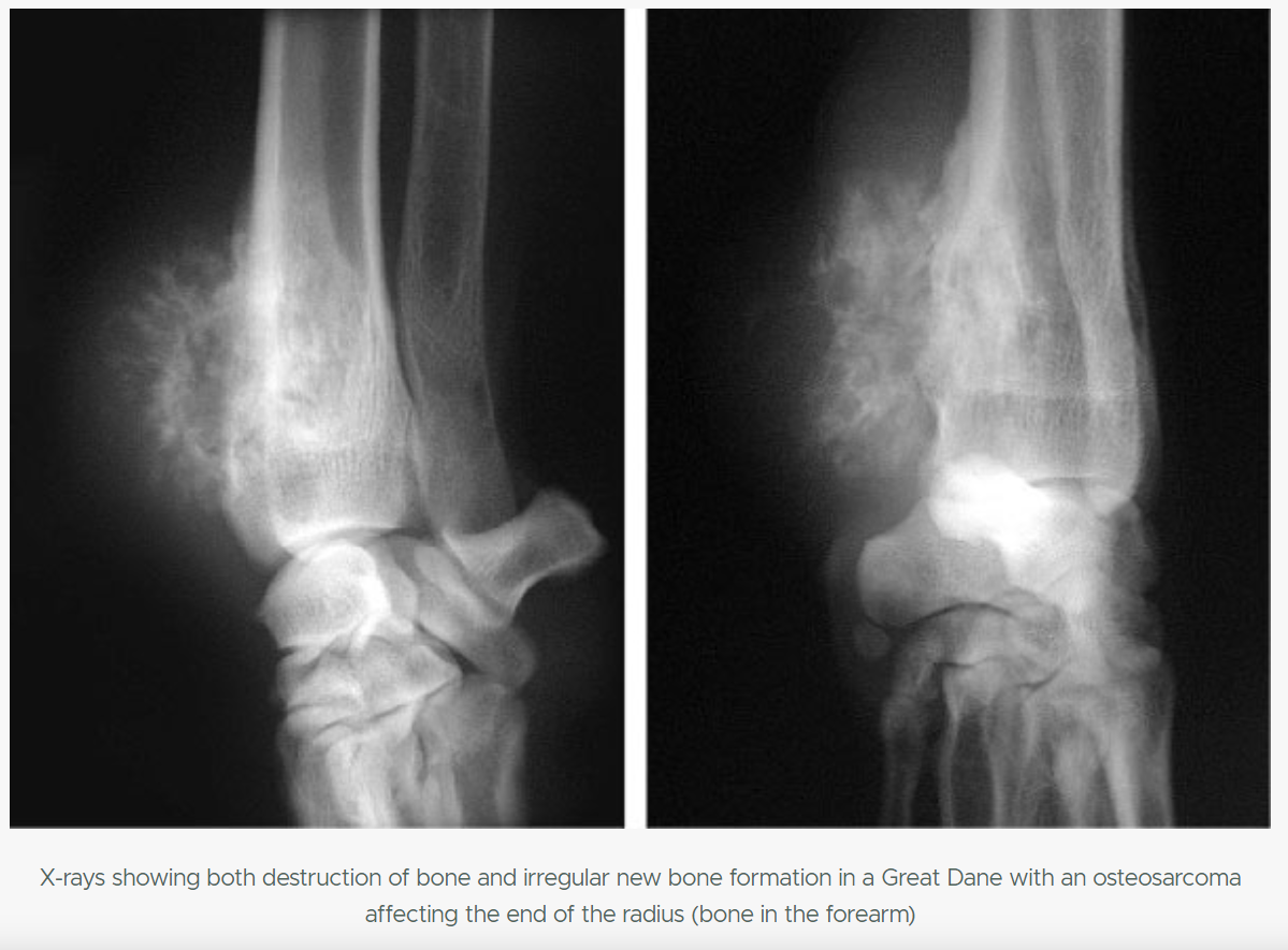 <p>Tumors → can be <strong>benign</strong> (only affecting one place) or <strong>malignant </strong>(affecting several)</p><ol><li><p><strong>Primary</strong></p><ul><li><p>from tissue where they are found</p></li><li><p>types: multiple myeloma in blood/bone marrow, chondrosarcoma in cartilage, osteosarcoma in bone, fibrosarcoma in CT</p></li></ul></li><li><p><strong>secondary</strong></p><ul><li><p>cancer that have spread from another part of body, through blood or lymphatic vessels. </p></li></ul></li></ol><p></p>