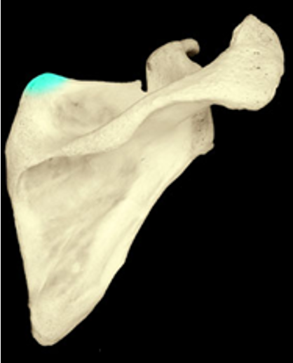 <p>the angle of the scapula where the medial and superior borders meet</p>