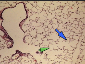 <p>Function: filtration (kidneys) and rapid diffusion (air sacs of lungs) </p><p>Location: kidney glomeruli, alveoli of lungs, lining of heart, kidney corpuscles, and blood and lymphatic vessels</p>