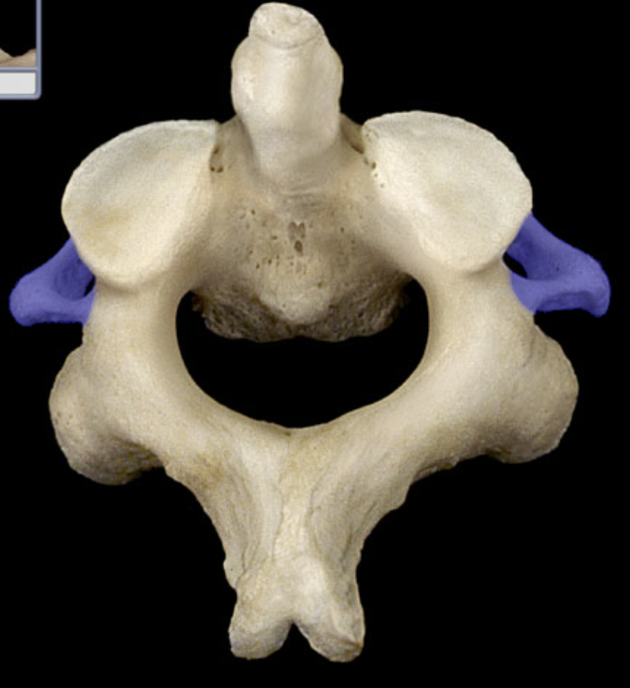 <p>(top - anterior)</p>