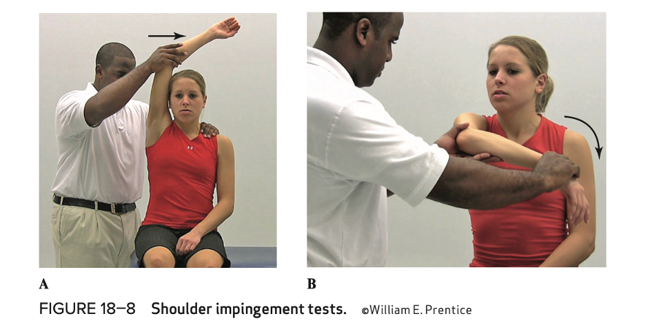 <p>Shoulder impingement test (purpose, how, positive sign ) </p>