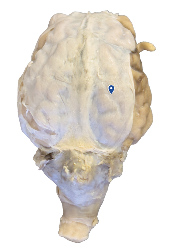 <p>What structure is the arrow pointing to?</p>