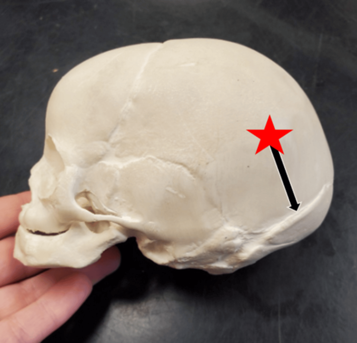 <p>Name the starred region in the image.</p>