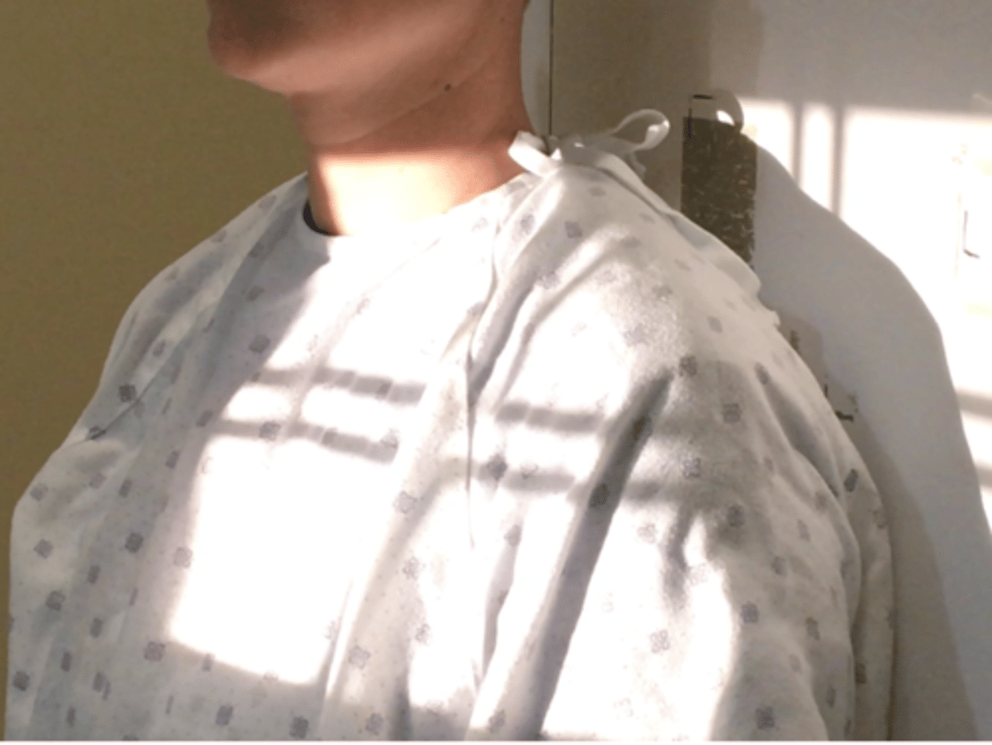 <p>Pt Placement: internal rotate arm until epicondyles are perpendicular to the film</p><p>Collimation: 12x10</p><p>CR Placement: Glenohumeral joint space, top of light 1.5" above the shoulder</p><p>Tube tilt: none</p><p>SID: 40"</p><p>Breathing: DBDM</p>