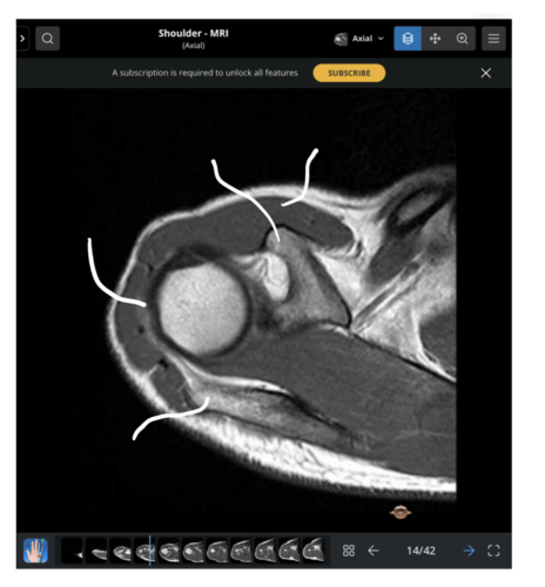 <p>Working our way clockwise, which structures are being pointed to in this image?</p>