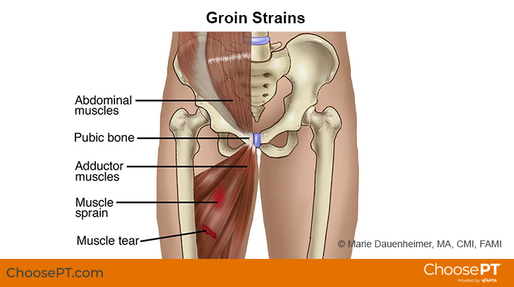 <p>Inguinal</p>