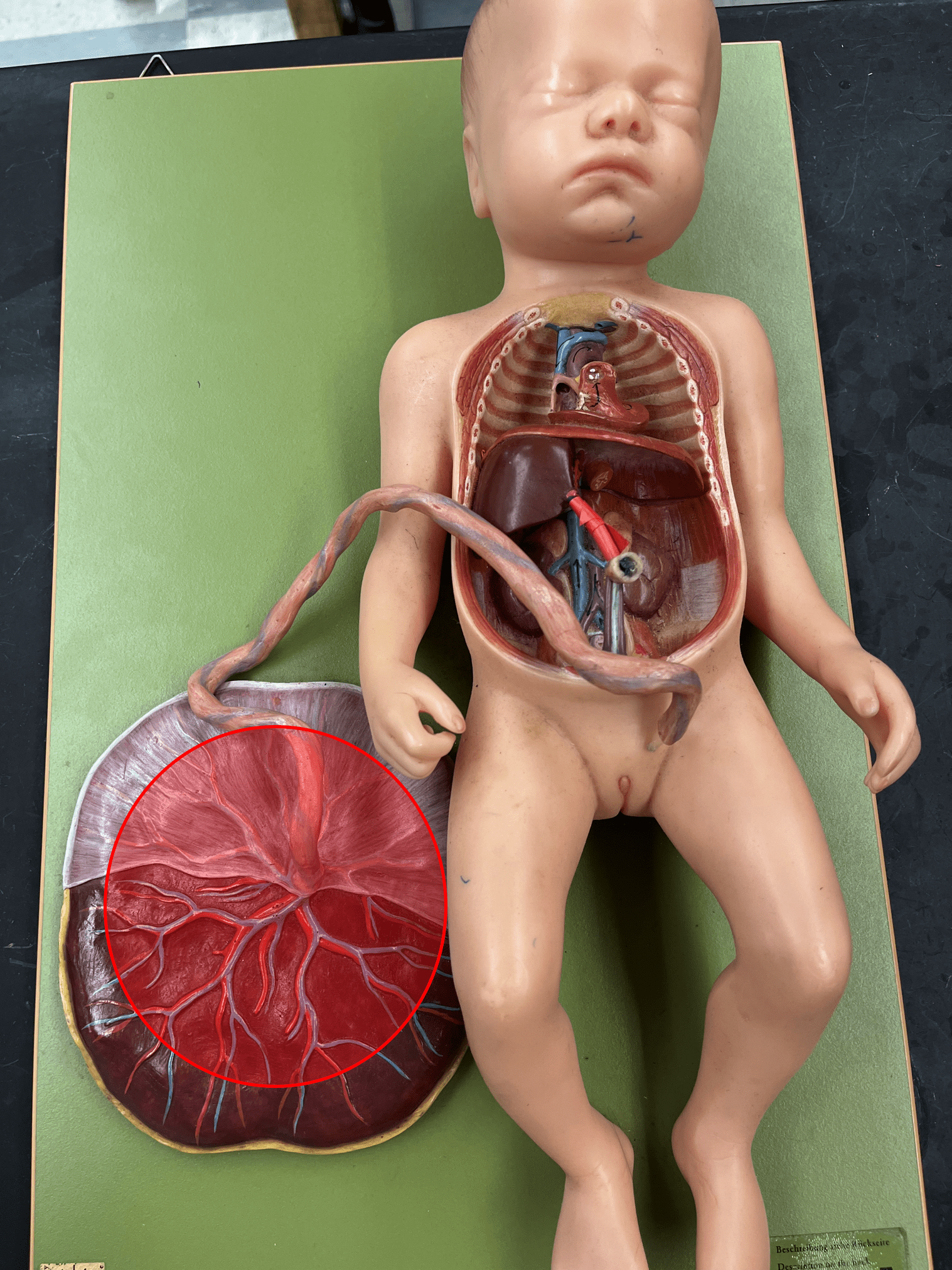 <p>• Part of the fetal circulation.</p>
<p>• Contains capillaries from the mother and allows for the exchange of resources between the mother and the fetus.</p>