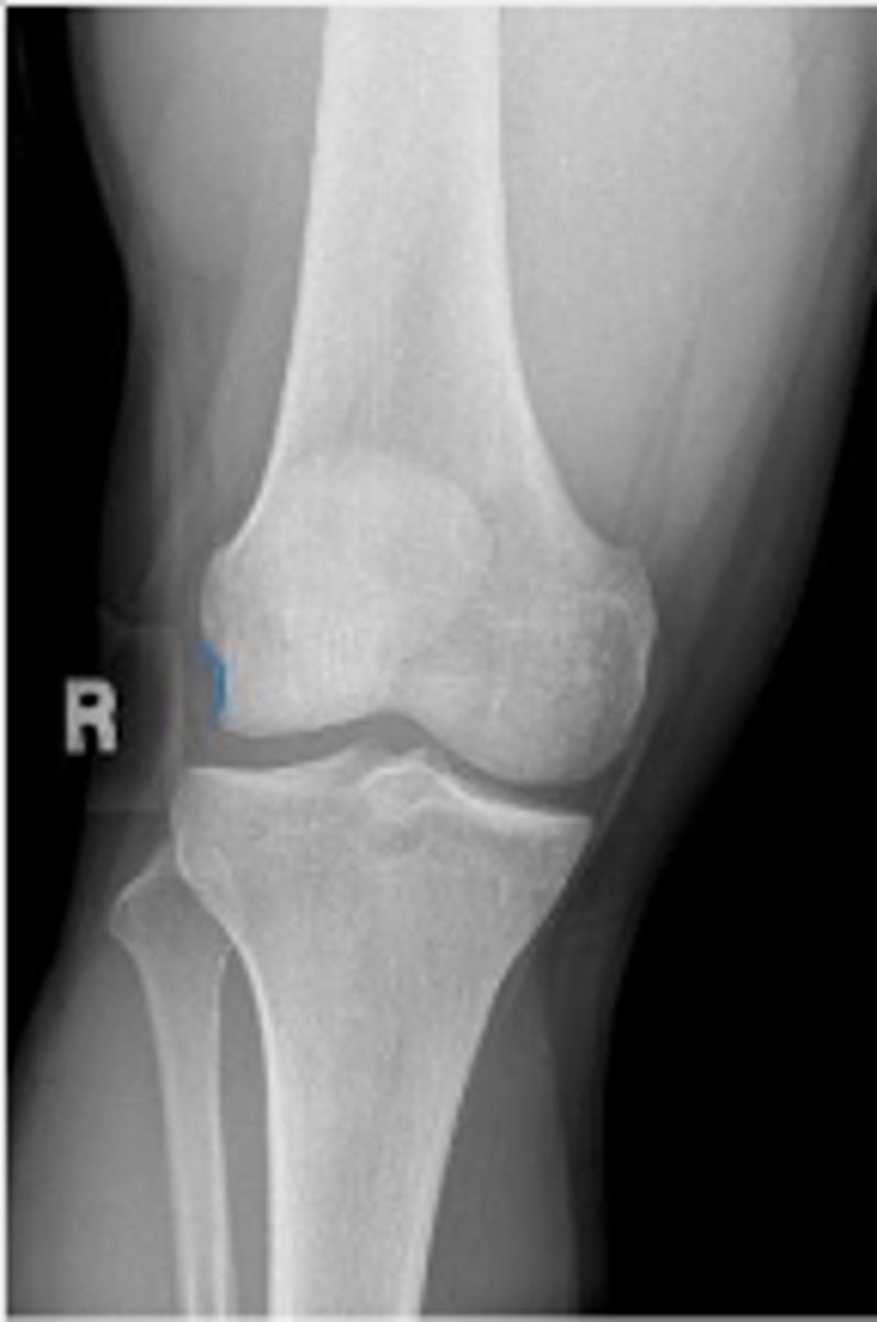 <p>What area is outlined?</p>