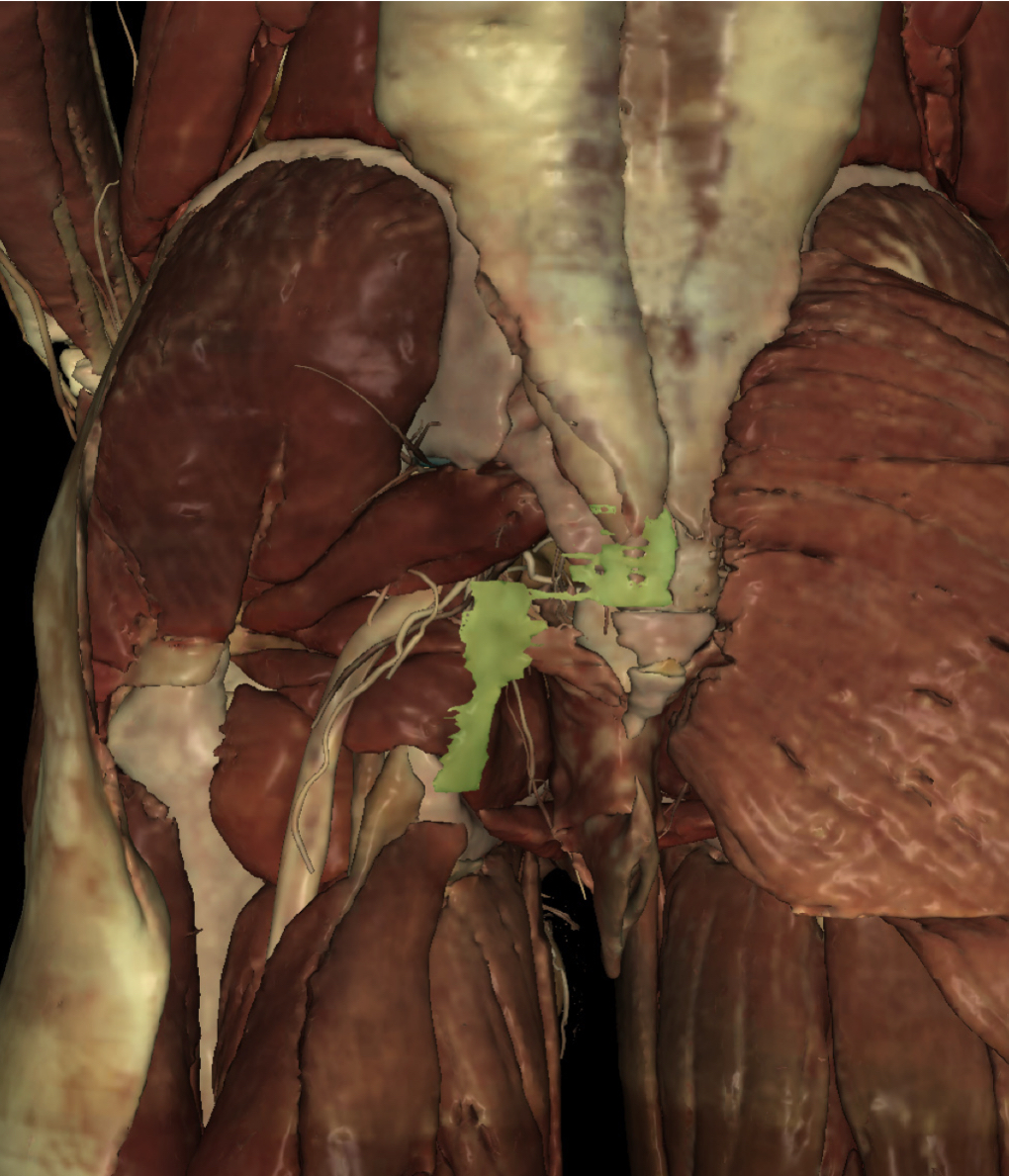 <p>Identify the Structure</p>